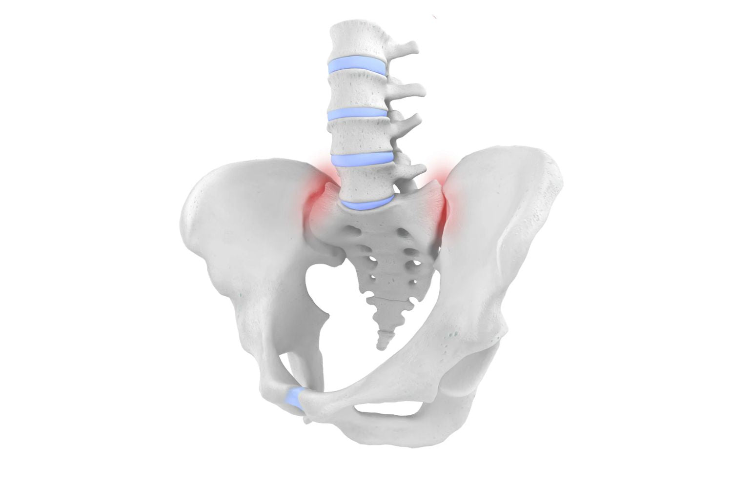Sacroiliac Joint Dysfunction