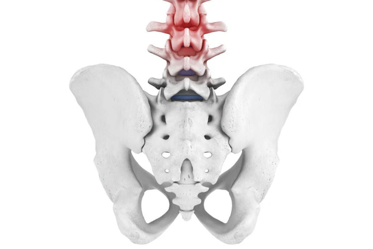 Lumbago - Lumbar Spine Syndrome
