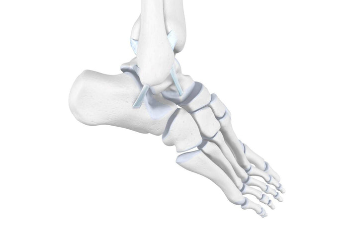 illustration of an everted ankle, with mall, blue ligaments straining to keep it in position