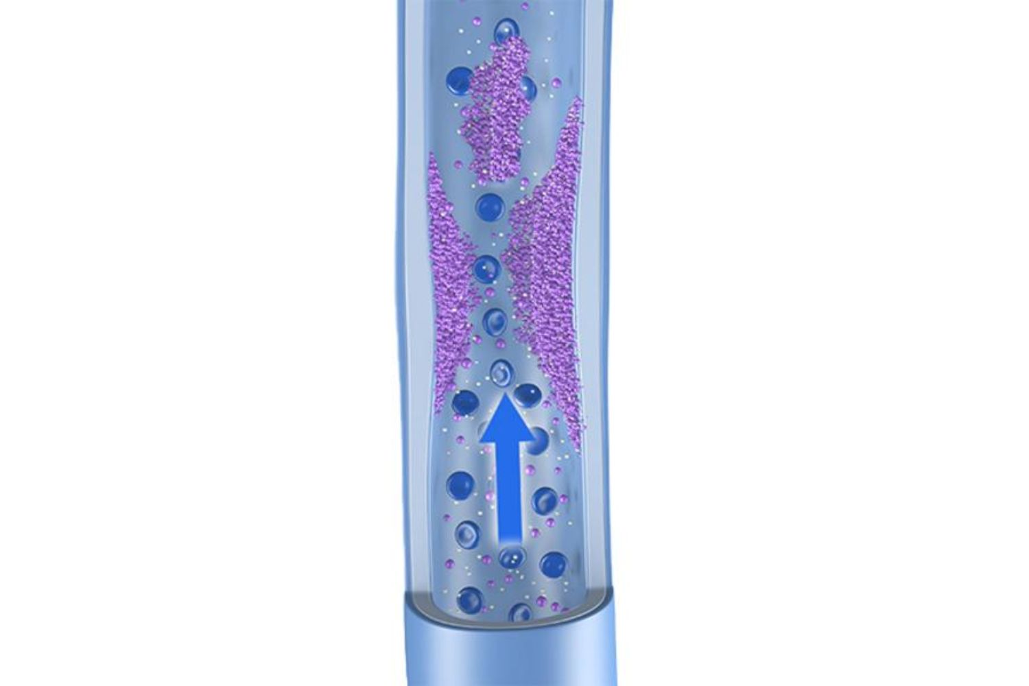 illustration of a vein where the blood flow is restricted by thrombi - indicating DVT