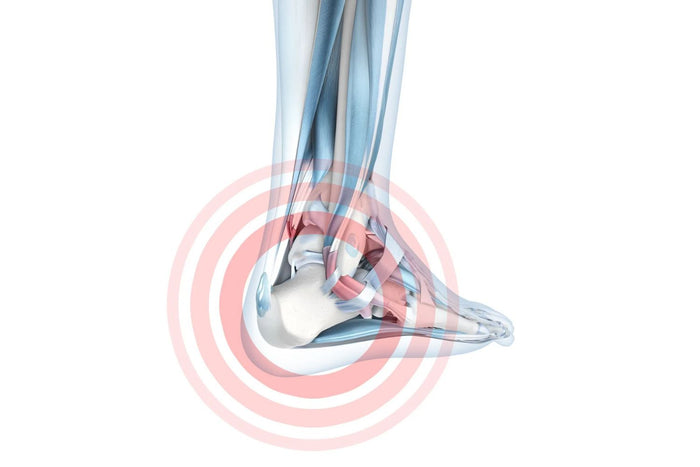 illustration of the foot and ankle. There is a red zone over the heel, indicating pain from work safety boots