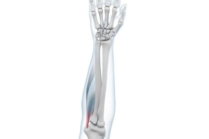 Golfers Elbow & Arm