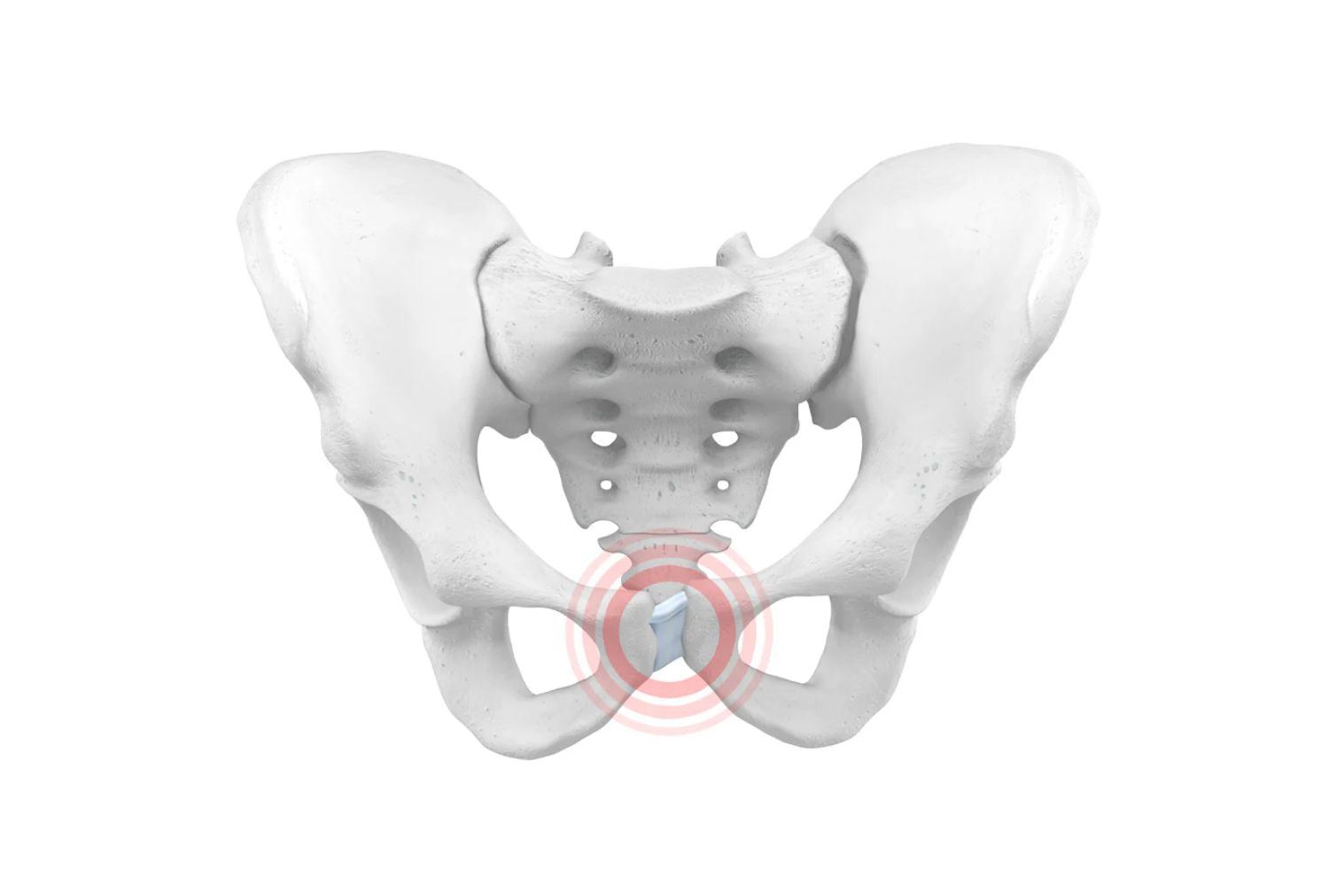 Illustration of the pelvic bones. There is a red circle around the pubis, indicating Symphysis Pubis Dysfunction 