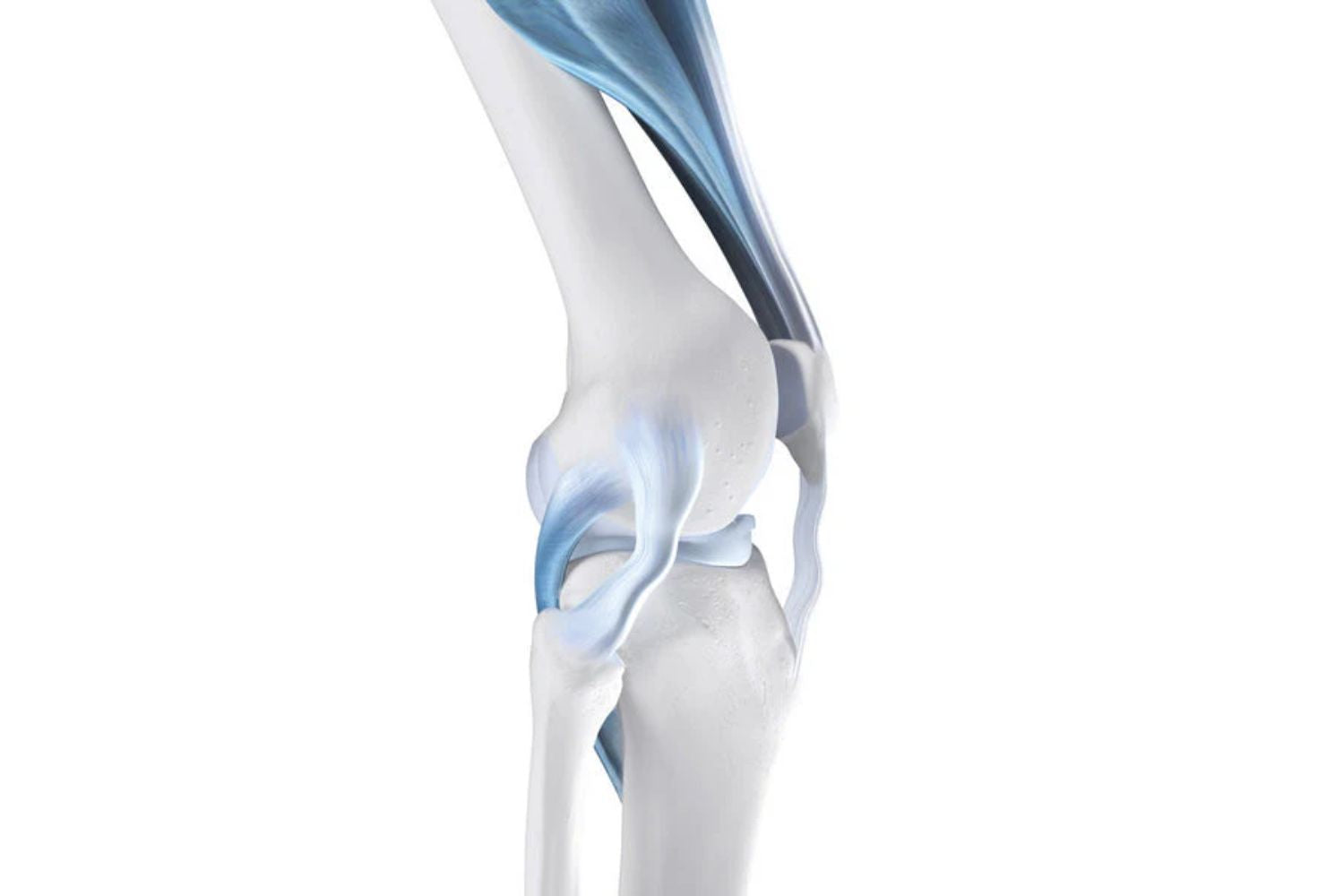 Knee Instability