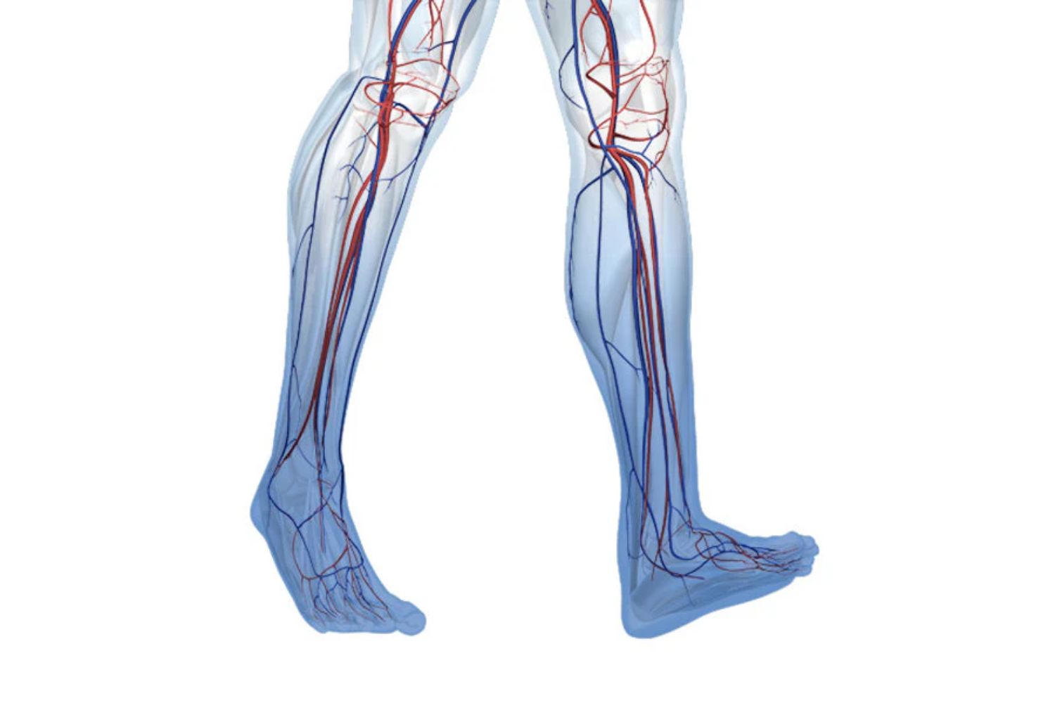 illustration of the lower legs. The feet and lower calves are blue, indicating circulation problems from chronic venous insufficiency 