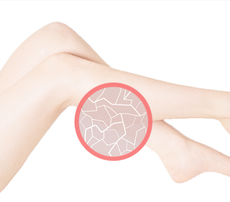 Image of leg highlighting dry skin