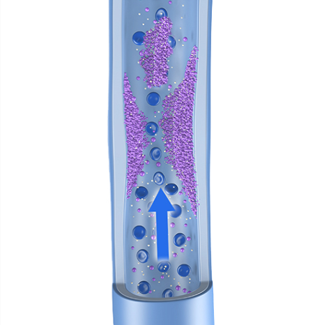 Deep Vein Thrombosis (DVT)