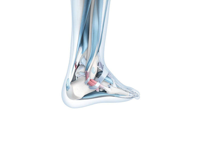 Ankle Instability