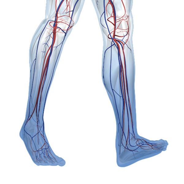 Chronic Venous Insufficiency (CVI) - Causes, Diagnosis and