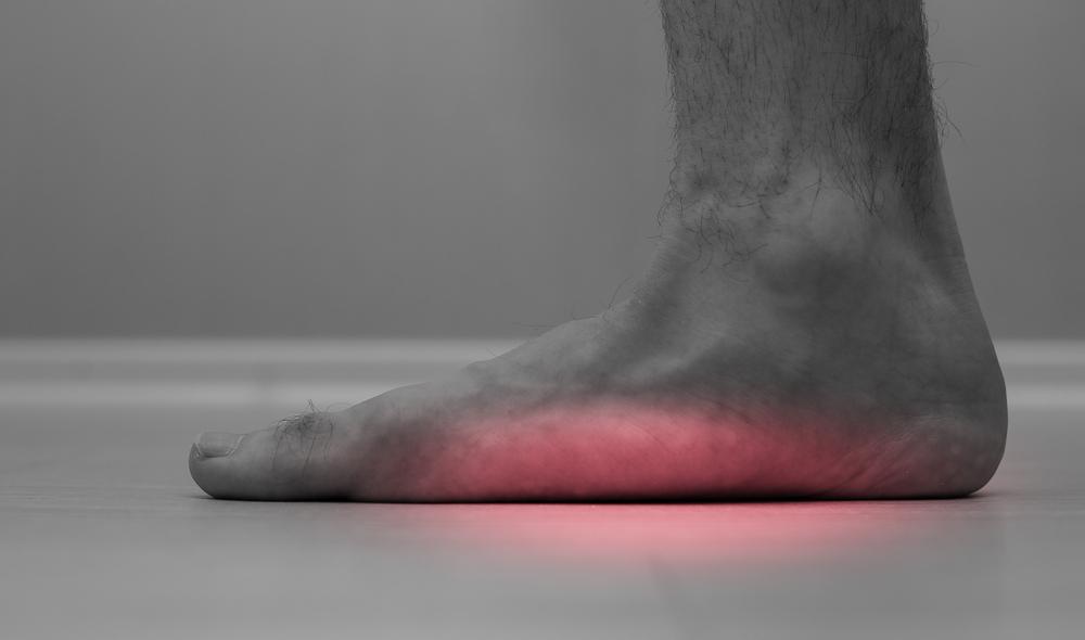 Can Flat Feet be Cured?