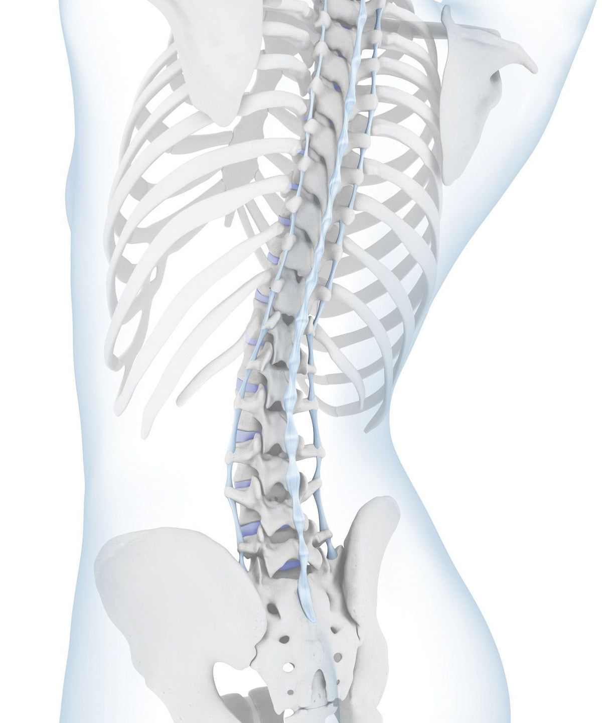 Hyperlordosis - Hollow Back