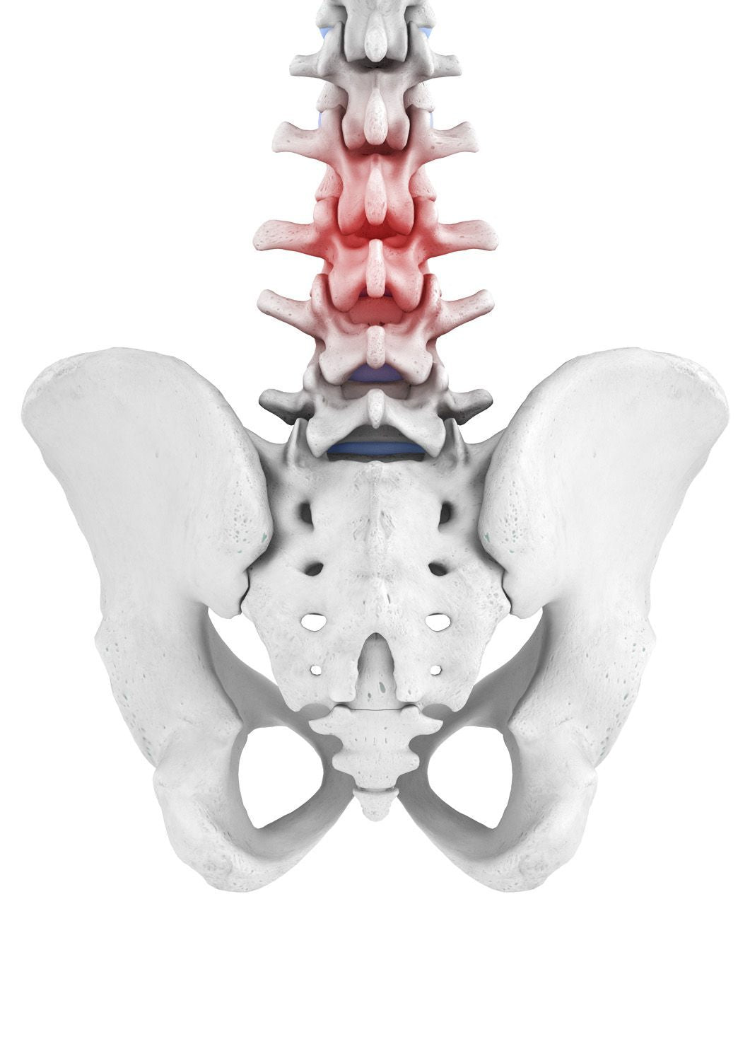 Lumbago - Lumbar Spine Syndrome