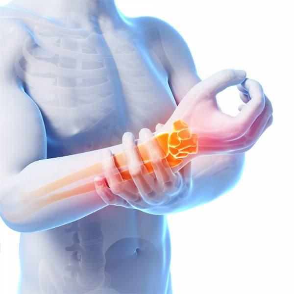 Wrist Injury in Sports