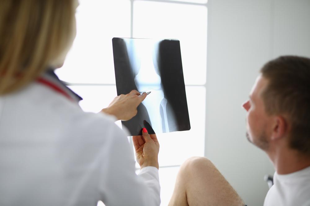 Treating a Knee Dislocation