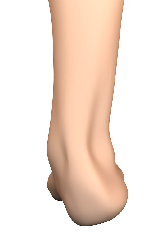 Sprained Ankle