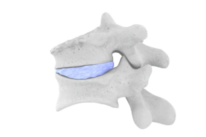 Vertebral Compression Fractures